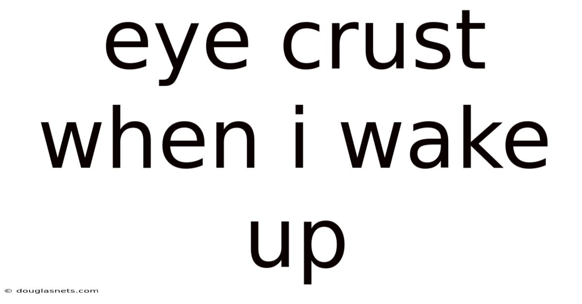 Eye Crust When I Wake Up