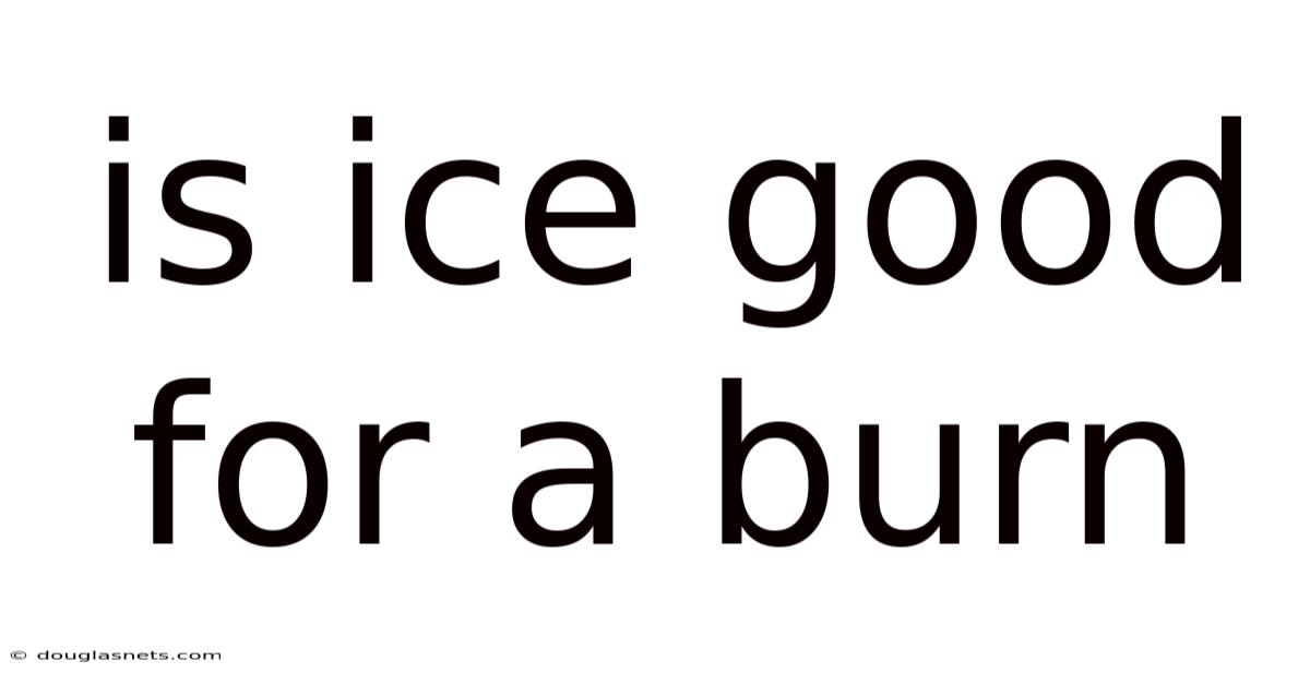 Is Ice Good For A Burn